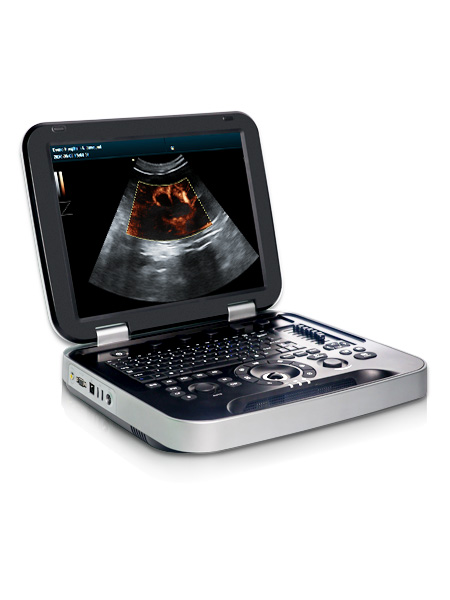Portable Pet Color Doppler PU-VL152A Portable Pet Color Doppler PU-VL152A