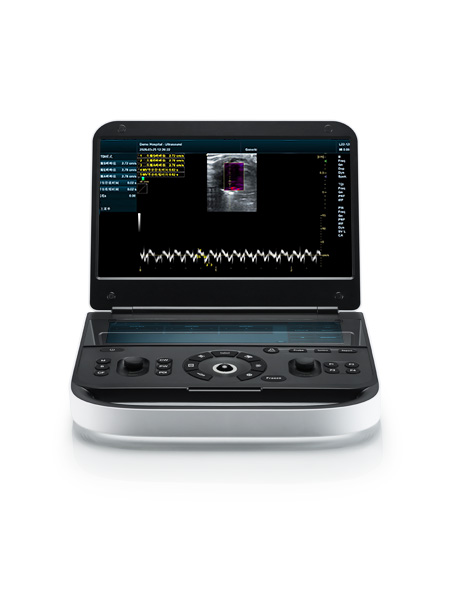 Revo 9 Vet Ultrasound Machine for Small Animals Revo 9 Vet Ultrasound Machine for Small Animals